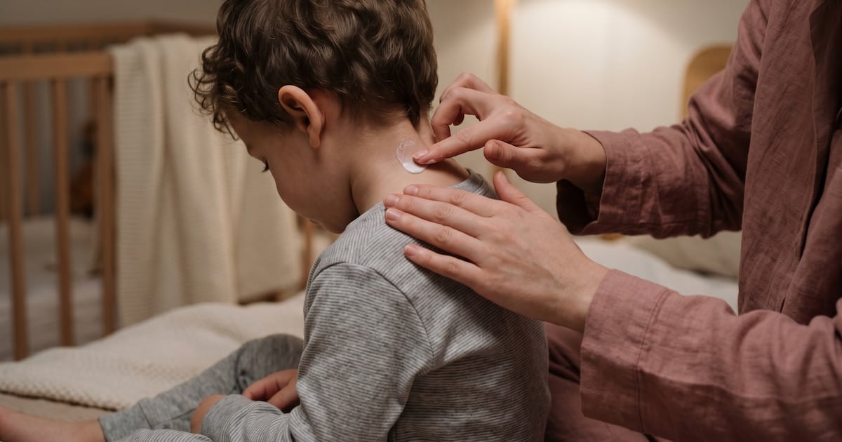 Dermatitis atópica: la economía empuja a casi la mitad de los pacientes a suspender sus controles