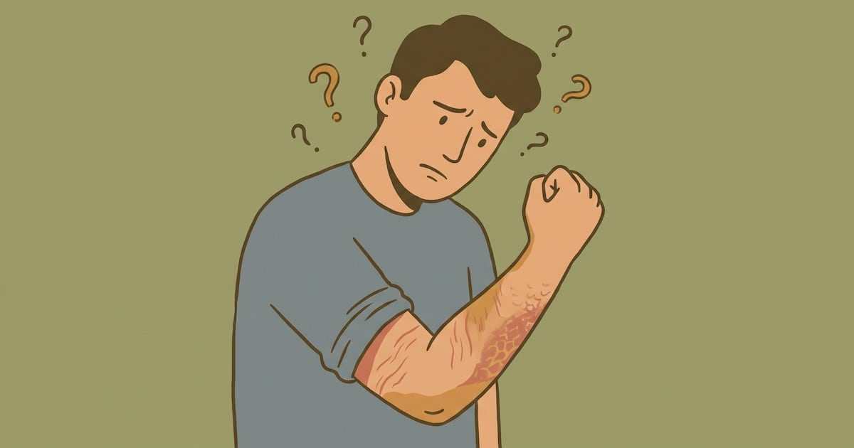 Piel que pica, piel que se inflama: las claves para distinguir sequedad de eccema y cuándo ir al dermatólogo