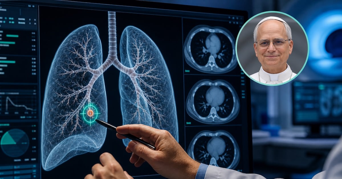 Nódulo pulmonar de tres milímetros: por qué la prudencia médica muchas veces le gana al tamaño
