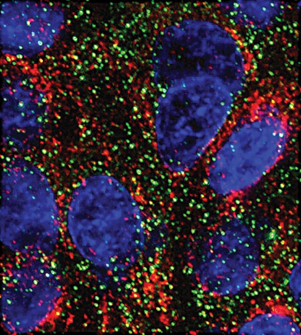 Dos microARN que slowed el avance del cáncer pancreático en el laboratorio